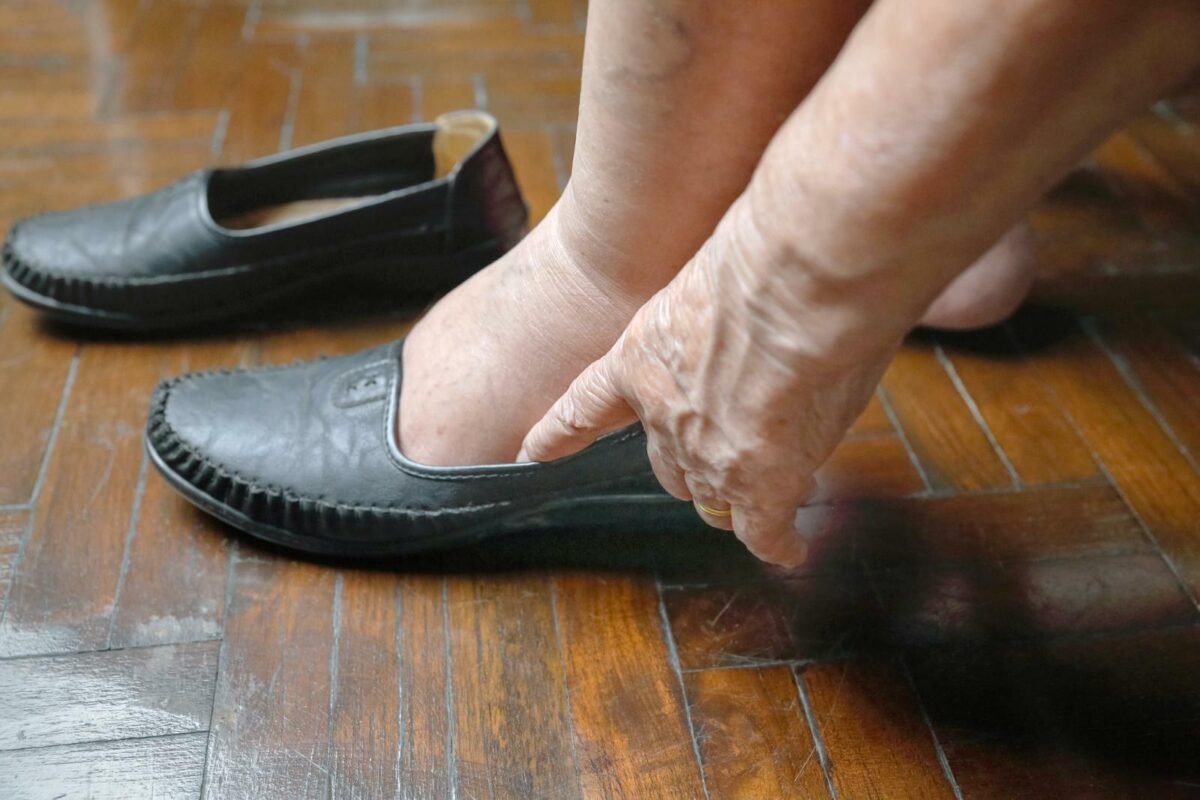 Hinchazón de piernas en adultos mayores: posibles causas y tratamientos